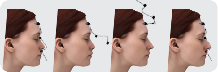 Nose profile simulations